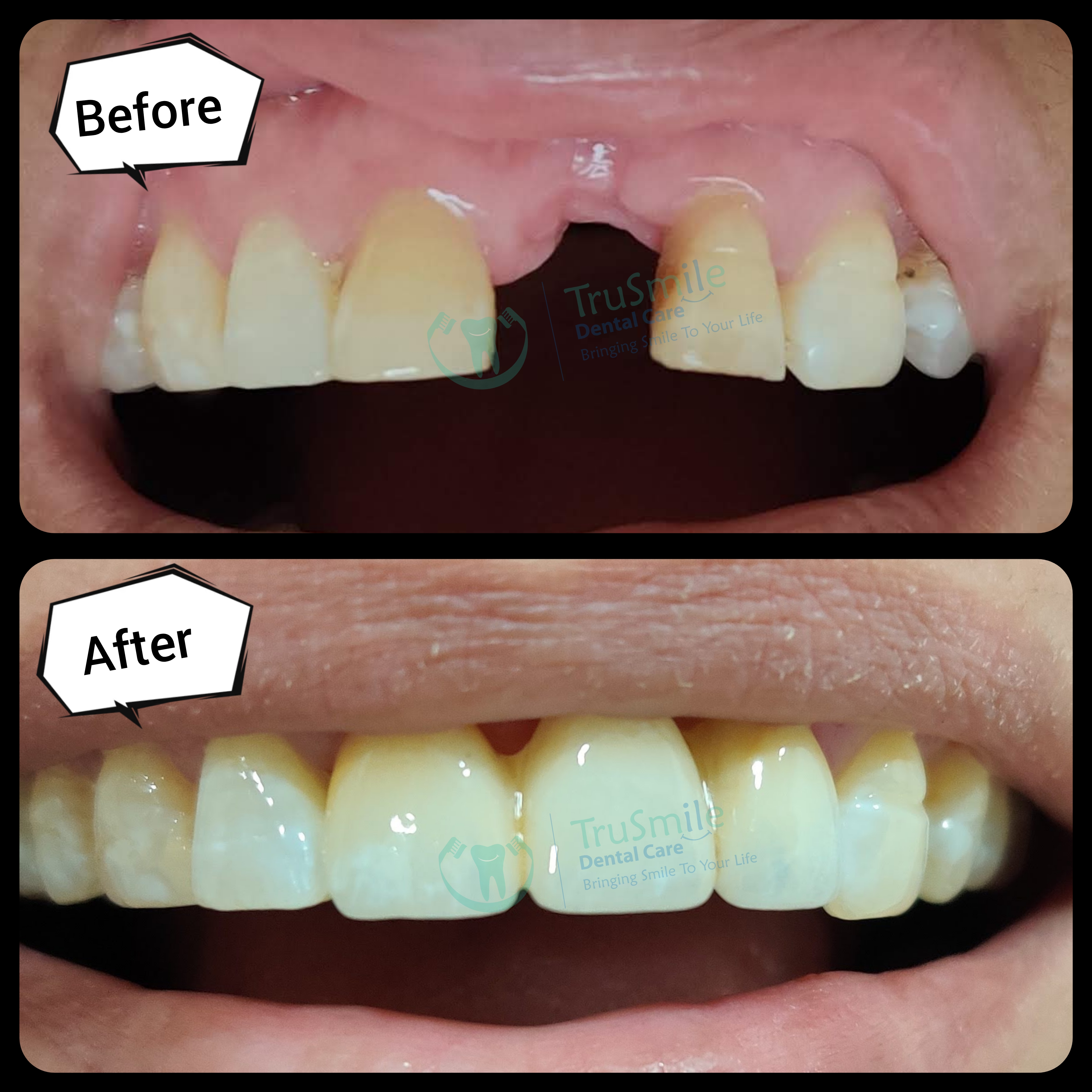 Smile Design 2